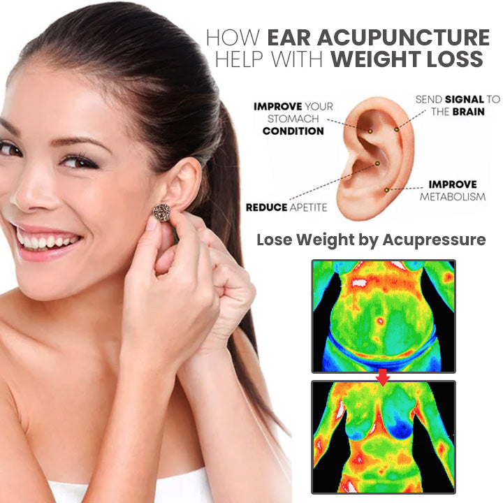 Zlassic MagneTech Acupuncture Earrings（Limited Time Discount 🔥 Last Day）